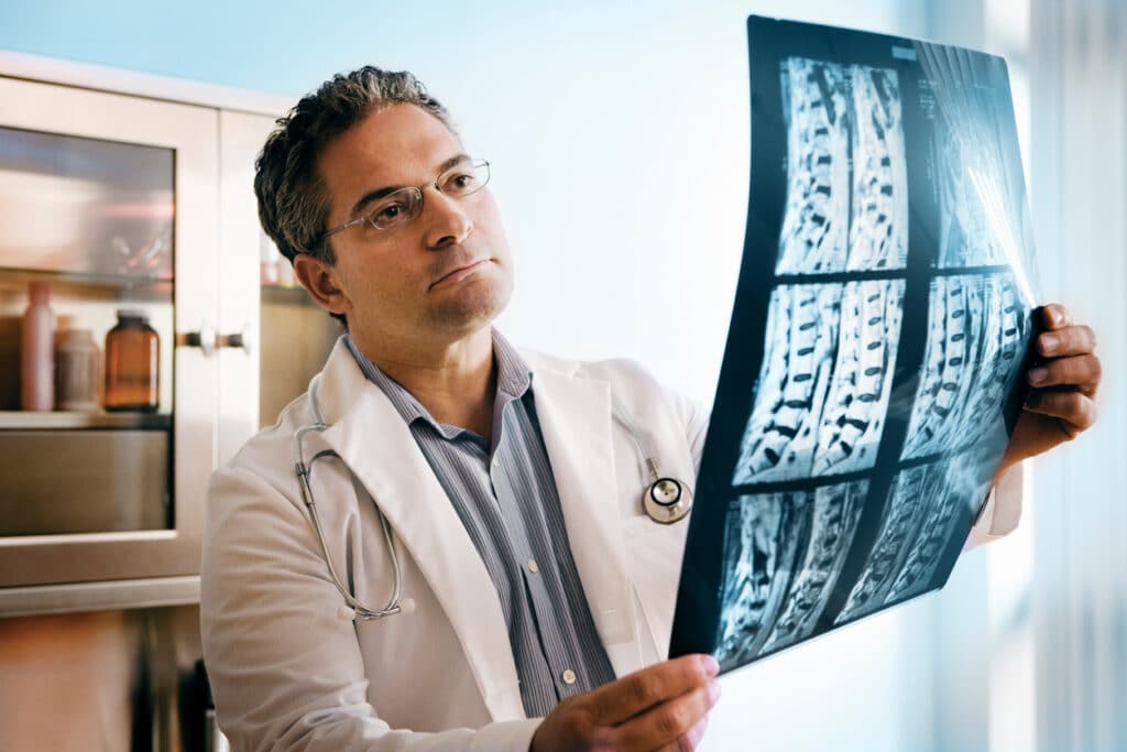Doctor looking at MRI of spinal cord.