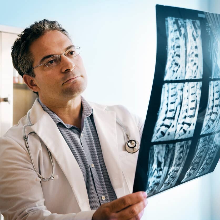 Doctor looking at MRI of spinal cord.